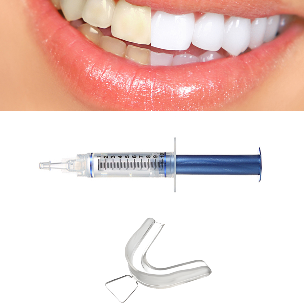 Teeth Whitening & Teeth Grinding Mouth Trays With Optional Teeth Whitening Gel